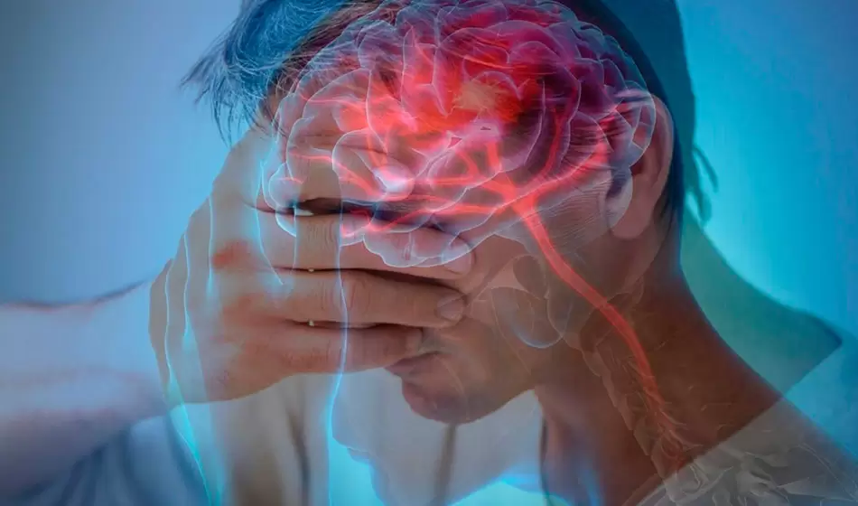 Hay dos tipos principales de accidente cerebrovascular: Accidente cerebrovascular isquémico y Accidente cerebrovascular hemorrágico